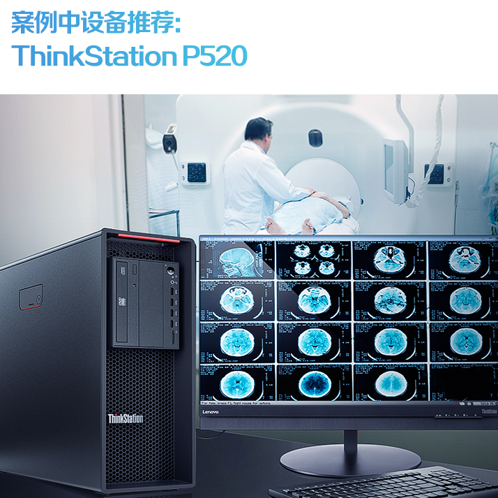 聯(lián)想ThinkStation P520為醫療CT設備制造商提供全生命周期解決方案